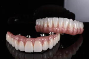 How I Discovered Dental Bridges Mathoura After Struggling With a Missing Tooth Concern