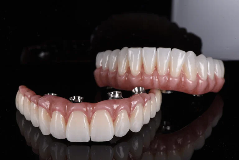 How I Discovered Dental Bridges Mathoura After Struggling With a Missing Tooth Concern